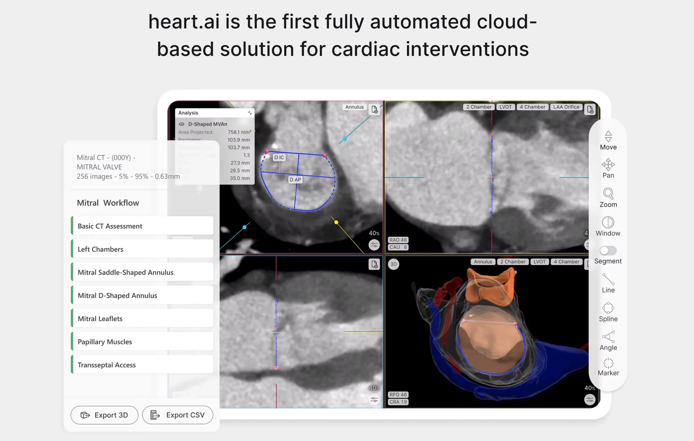 heart.ai