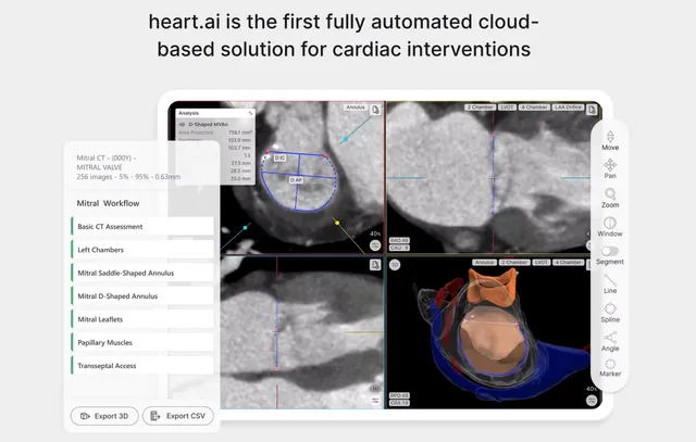 heart.ai